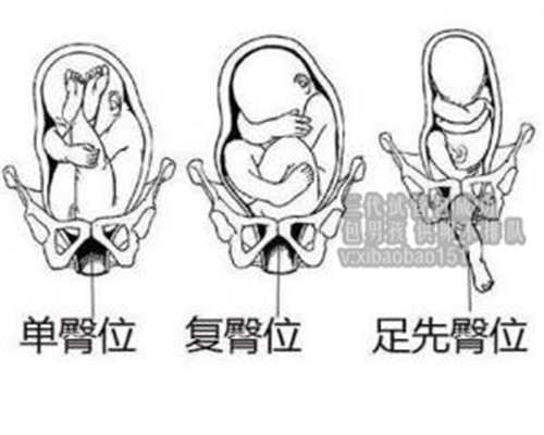 助孕公司北京,助孕要带什么首饰,输卵管堵塞如何治疗中医能治好吗