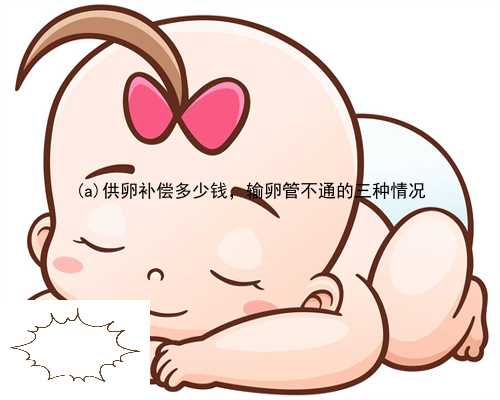 梓潼县供卵补偿多少钱，输卵管不通的三种情况
