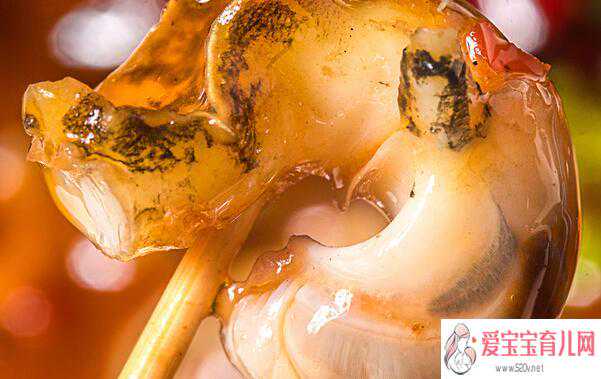 阿克塞哈萨克族自治县供卵孩子跟自己像吗，人流后可以吃海螺肉吗
