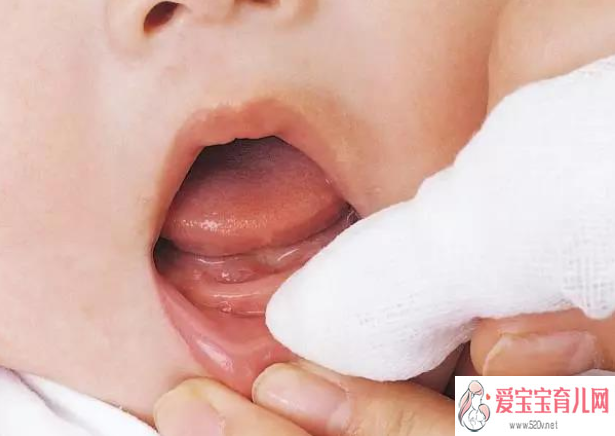城东区不孕不育供卵三代试管，宝宝出牙晚是谁决定的宝宝出牙护理小技巧