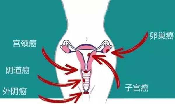 中国福孕助孕网,助孕膏要用开水冲吗,妇科炎症的一些常见症状，出现这4个症状