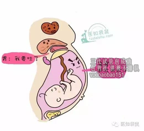 深圳助孕成功费用,卵巢早衰怎么检查出来的